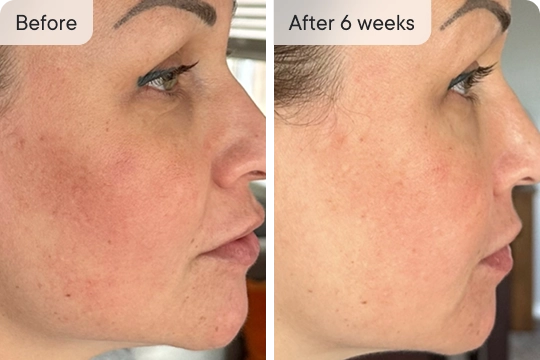 Thrilled with the results!