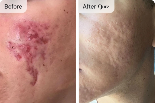 My skin returned to life!