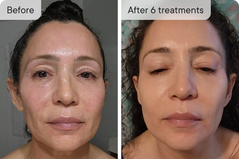 My skin returned to life!